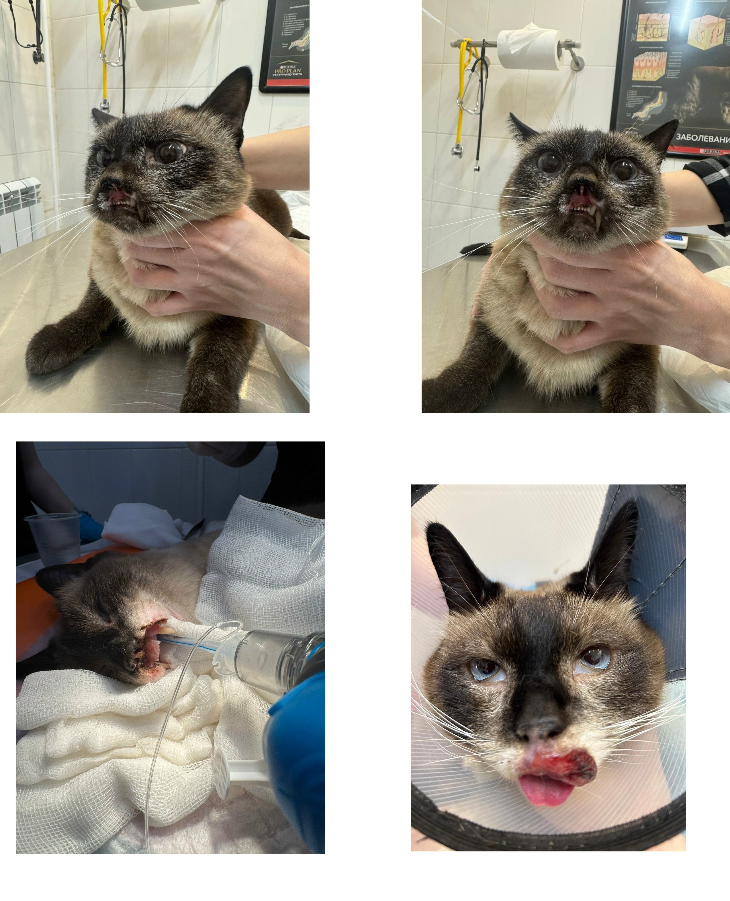 криохирургия в Туле